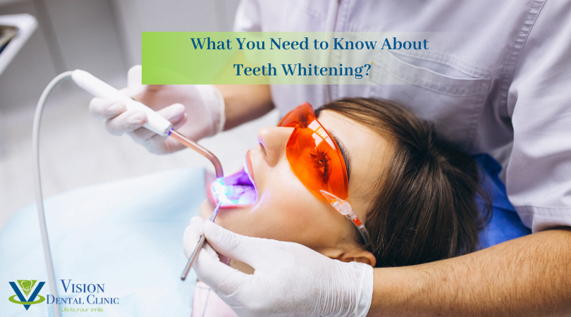 know about teeth whitening