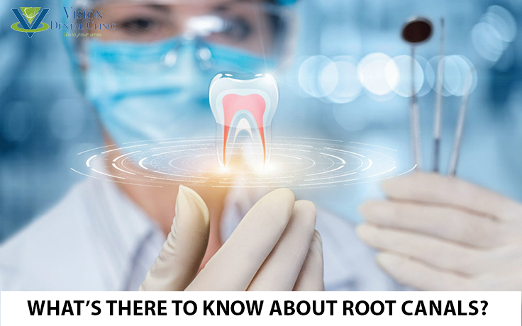 root canal tratment in abu dhabi