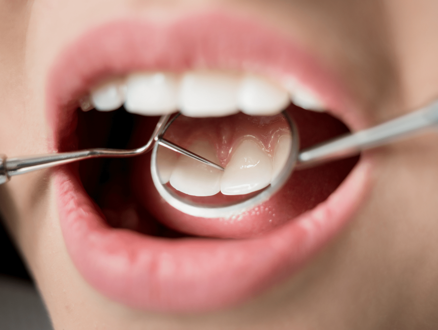 How often do I need to visit the Dentist?