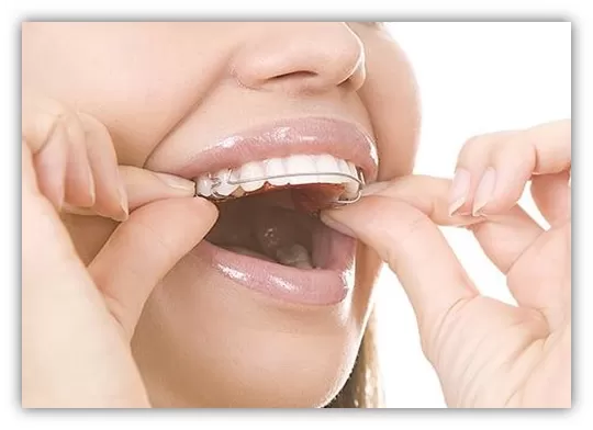 Tips For Cleaning A Retainer