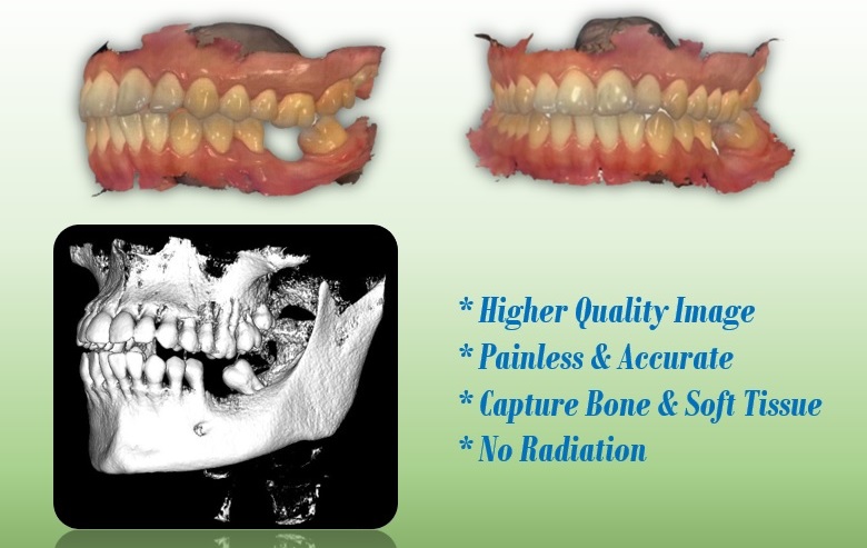 3d dental scanner