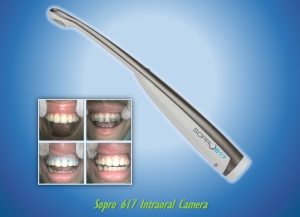 intraoral camera