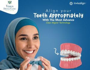 Invisalign cost in Abu Dhabi