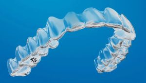 invisalign in abu dhabi