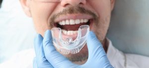 dental mouthguard in abu dhabi