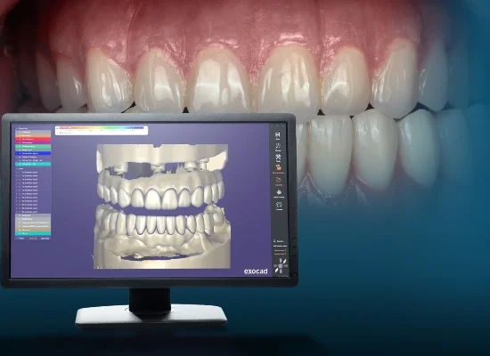3D Smile Design