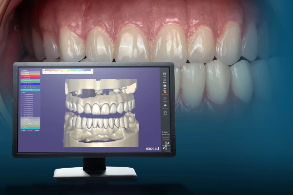3D Smile Design