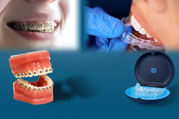 Orthodontics
