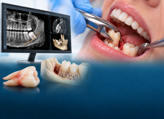 Oral Surgery